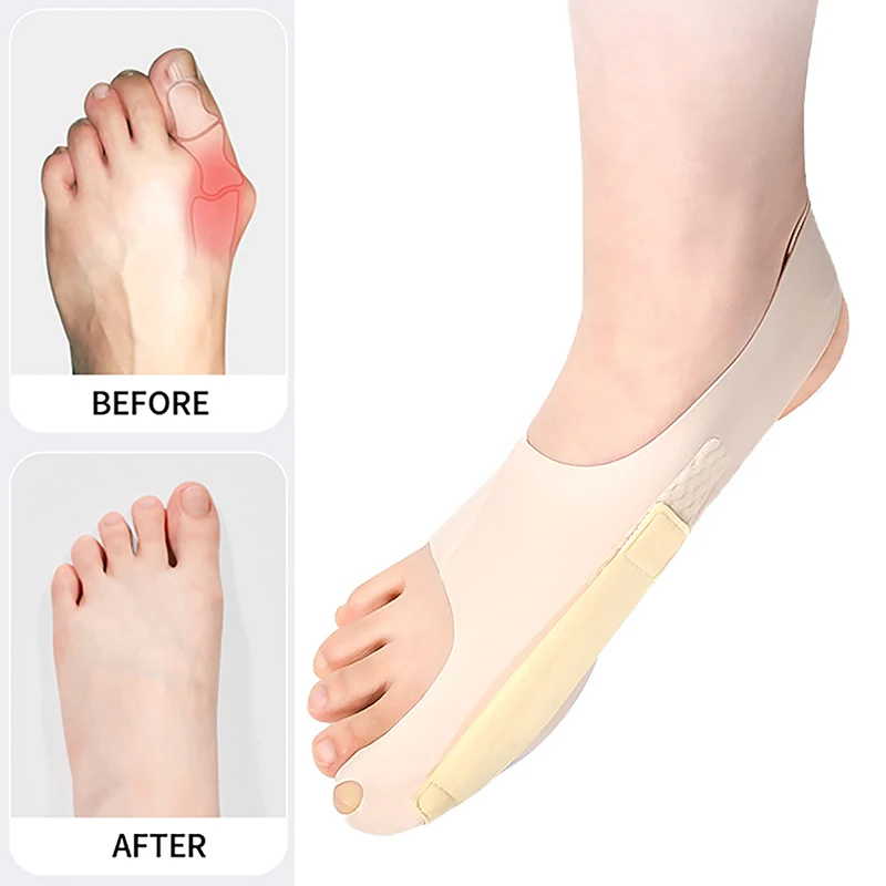 

1 Pcs Big Toe Protector Adjust Unisex Soft Pedicure Socks For Bunions Hallux Valgus Orthopedic Bandage Foot Care Toe Correction