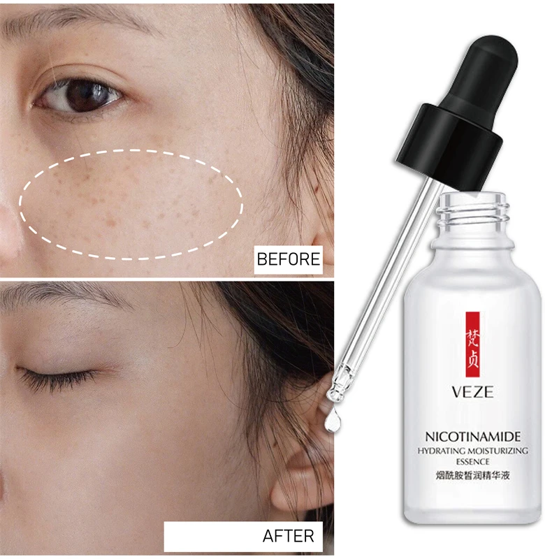 

Whitening Freckles Serum Remove Dark Spots Freckle Essence Anti-Aging Niacinamide Fade Pigmentation Melasma Brighten Skin Care