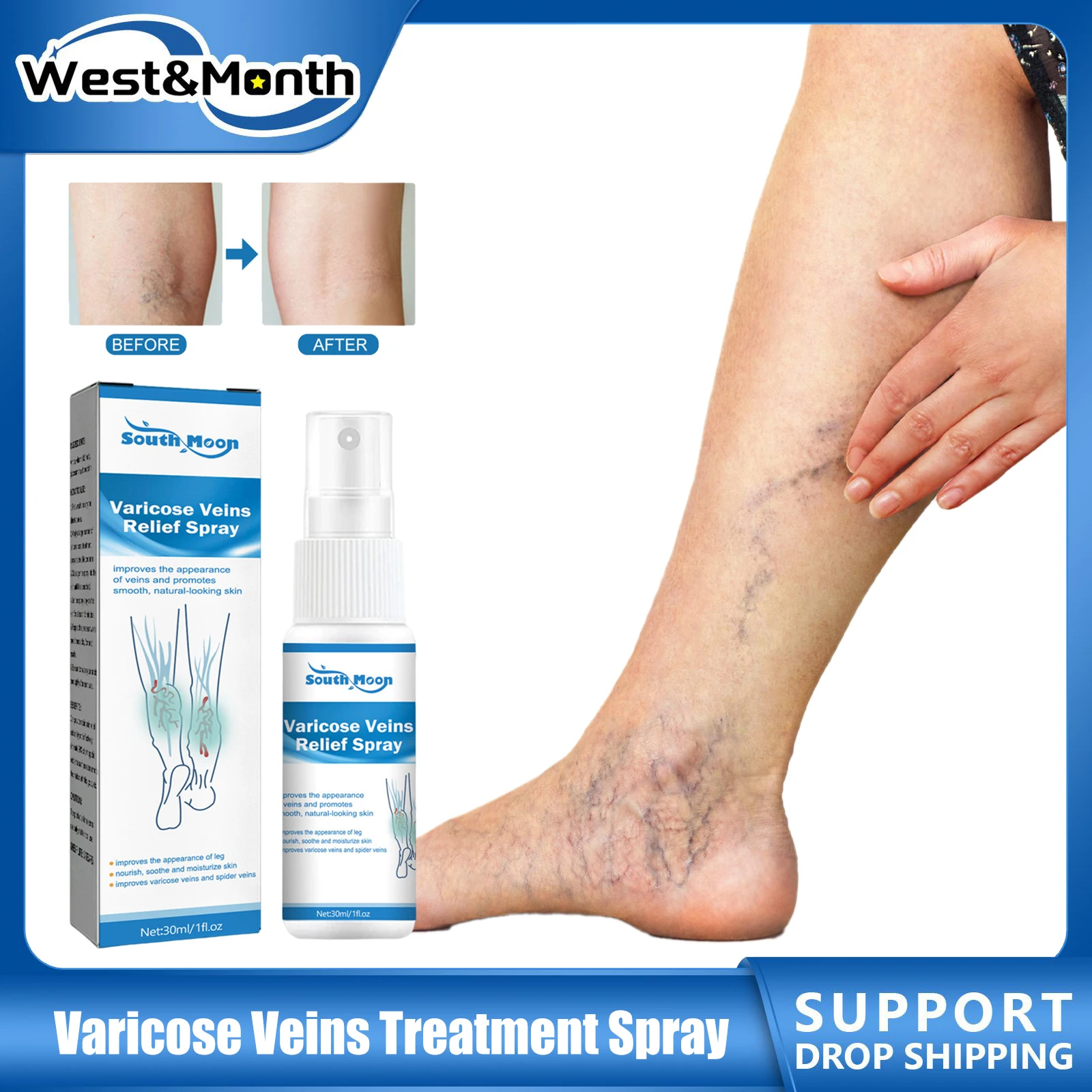 

Varicose Vein Treatment Spray Effective Relief Vasculitis Phlebitis Spider Earthworm Legs Improve Blood Vessel Redness Body Care