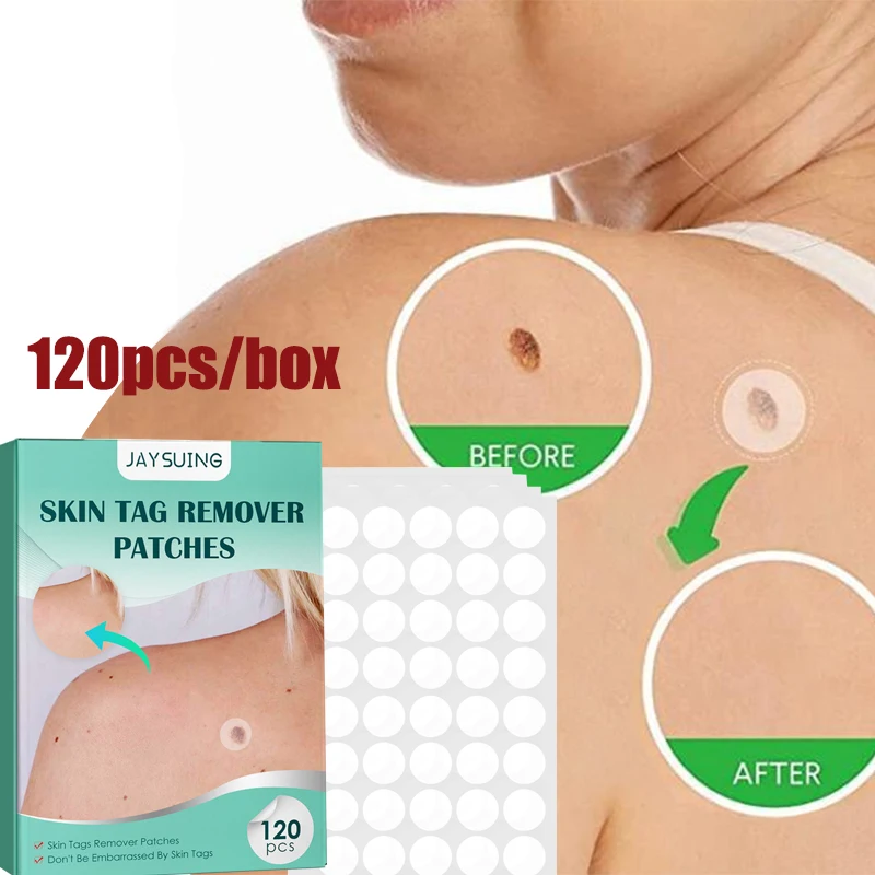 

120 шт., гидроколлоидный гель для лечения бородавок, акне и прыщей