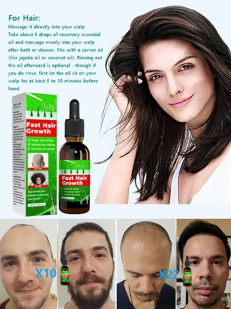 Быстрое средство для роста волос против выпадения травяное эфирное масло