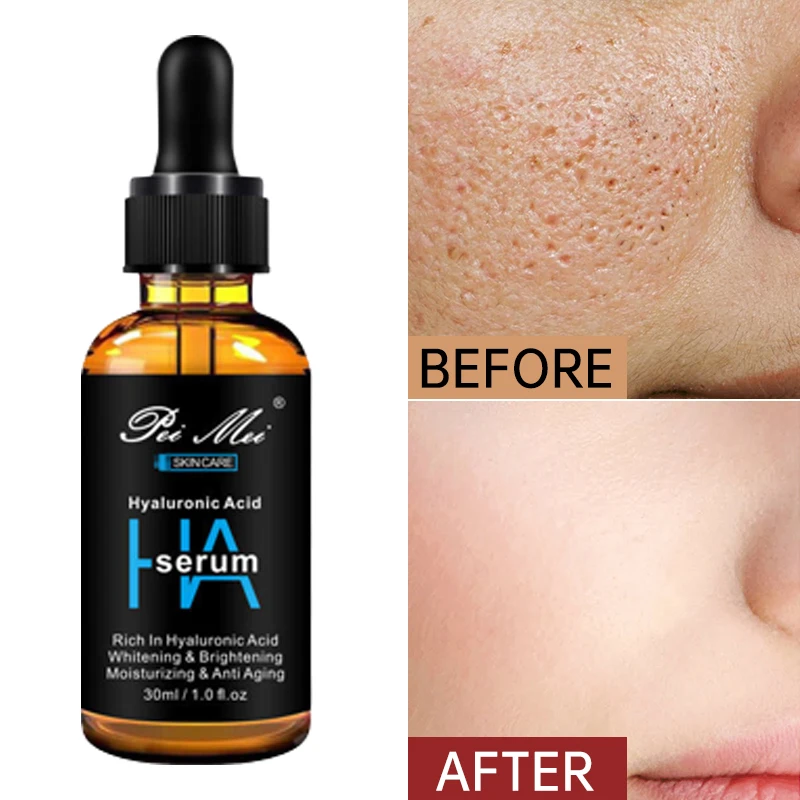 

Pore Shrinking Dark Spots Whitening Face Serum Skin Care For Glowing Niacinamide Hyaluronic Acid Collagen Facial Essence Beauty