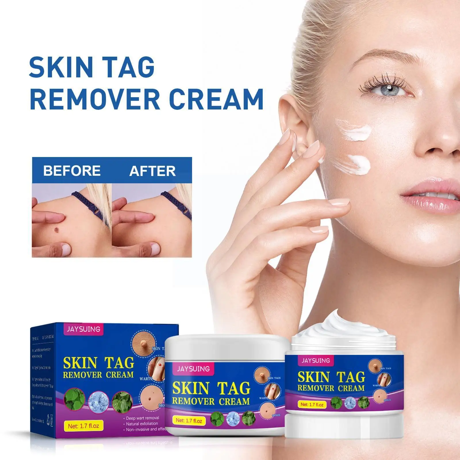 

50g Women Wart Remover Safe Painless Skin Tag Removal Ointment Fast Acting Cream For All Skin Care K8n7