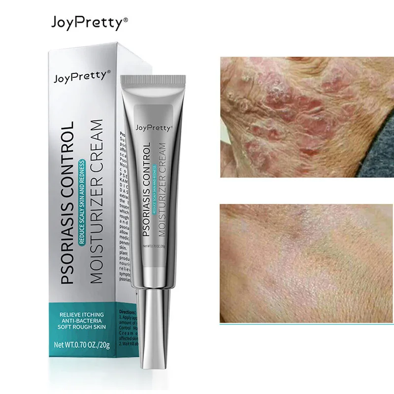 

Against Psoriasis Cream Natural Herbal Ointment Antibacterial Gel Anti-Itch Eczematoid Urticaria Psoriasis Skin Treatment 20g