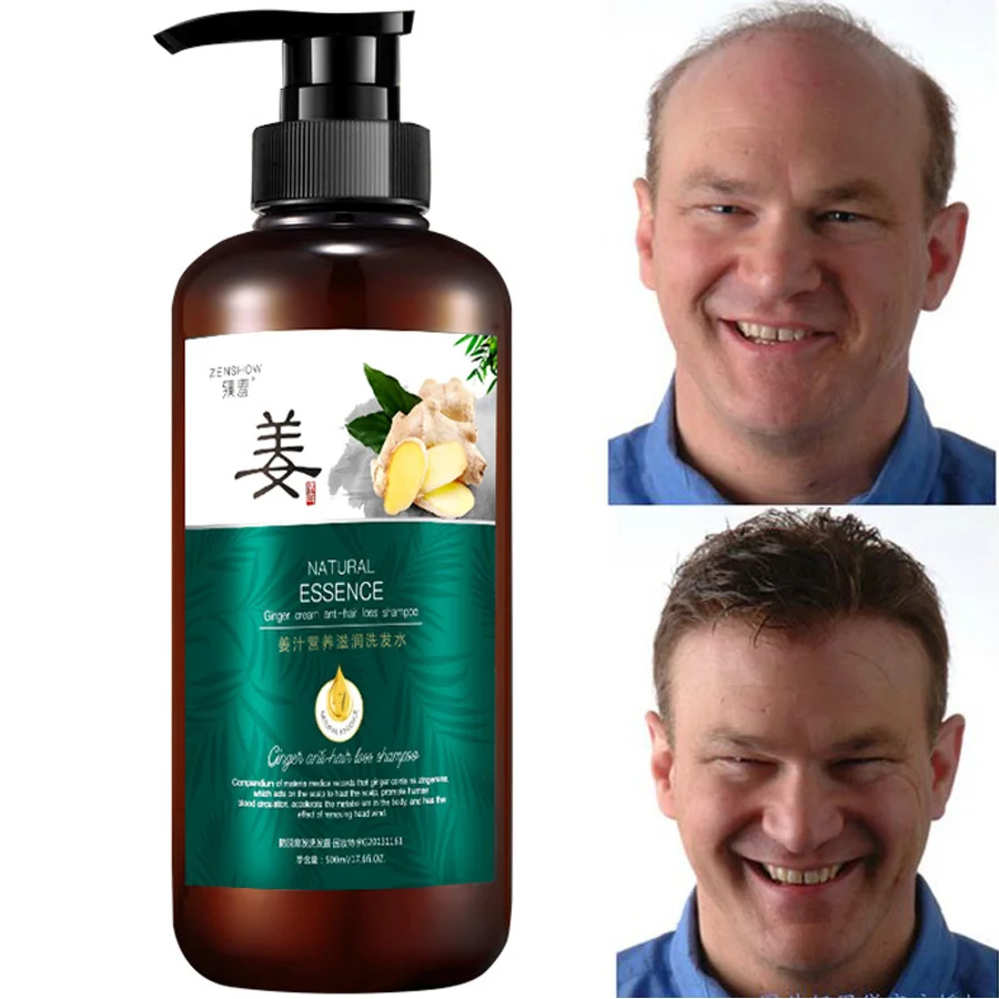 

Шампунь имбирный для восстановления и удаления перхоти, 500/300 мл