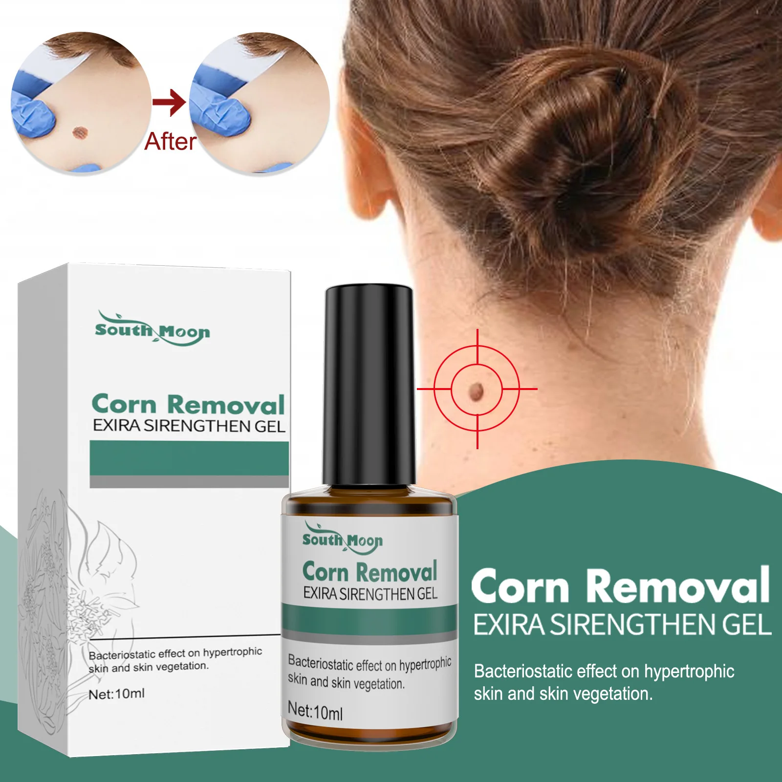 

Wart Removal Liquid Antibacterial Wart Treatment Cream Skin Remover Herbal Extracts Corn Paste Face Tag Liquid 10ml