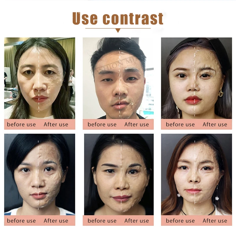 Miracle Face Mask Hyaluronic Acid Mask Korean Skin Care Cream Makeup Peptide Essence 3D Repair Set for Anti-wrinkle Anti-aging images - 6