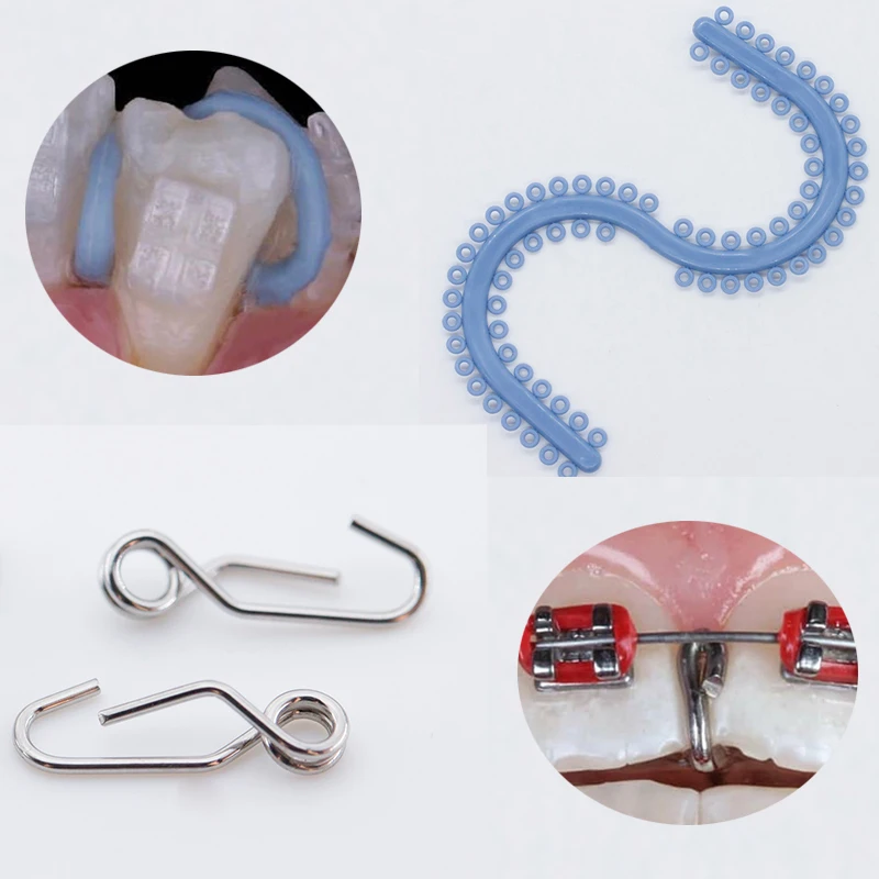 Стоматологический ортодонтический сепаратор пружинный синий круг 10 шт.