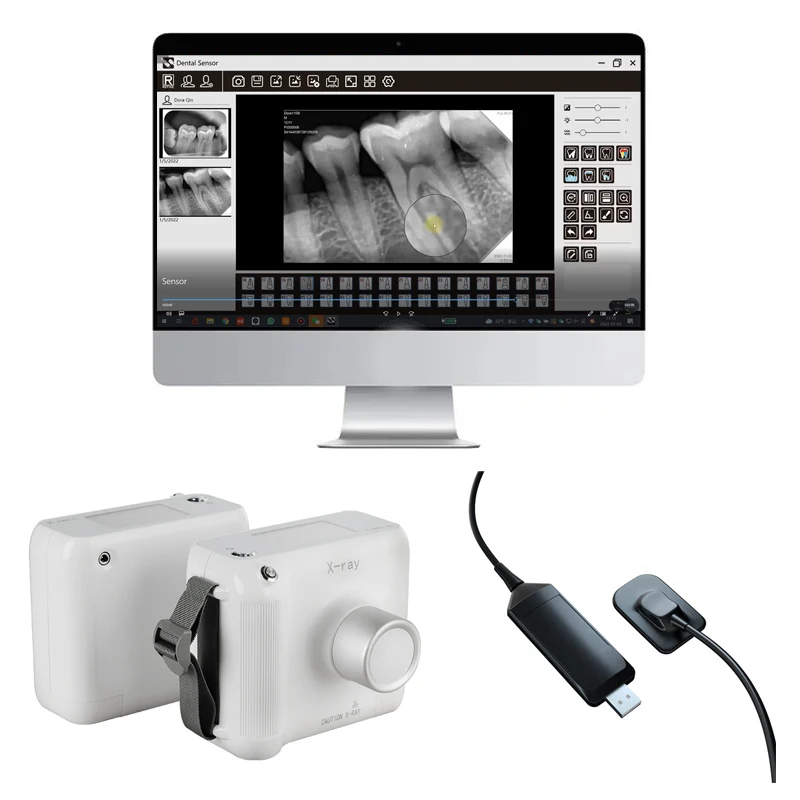 

Dental Equipment Combination Digital Portable X Ray Machine Dental Sensor