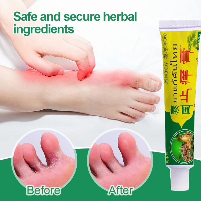 3 шт./лот Таиландские травяные кремы материал от псориаза экземы мазь крем для