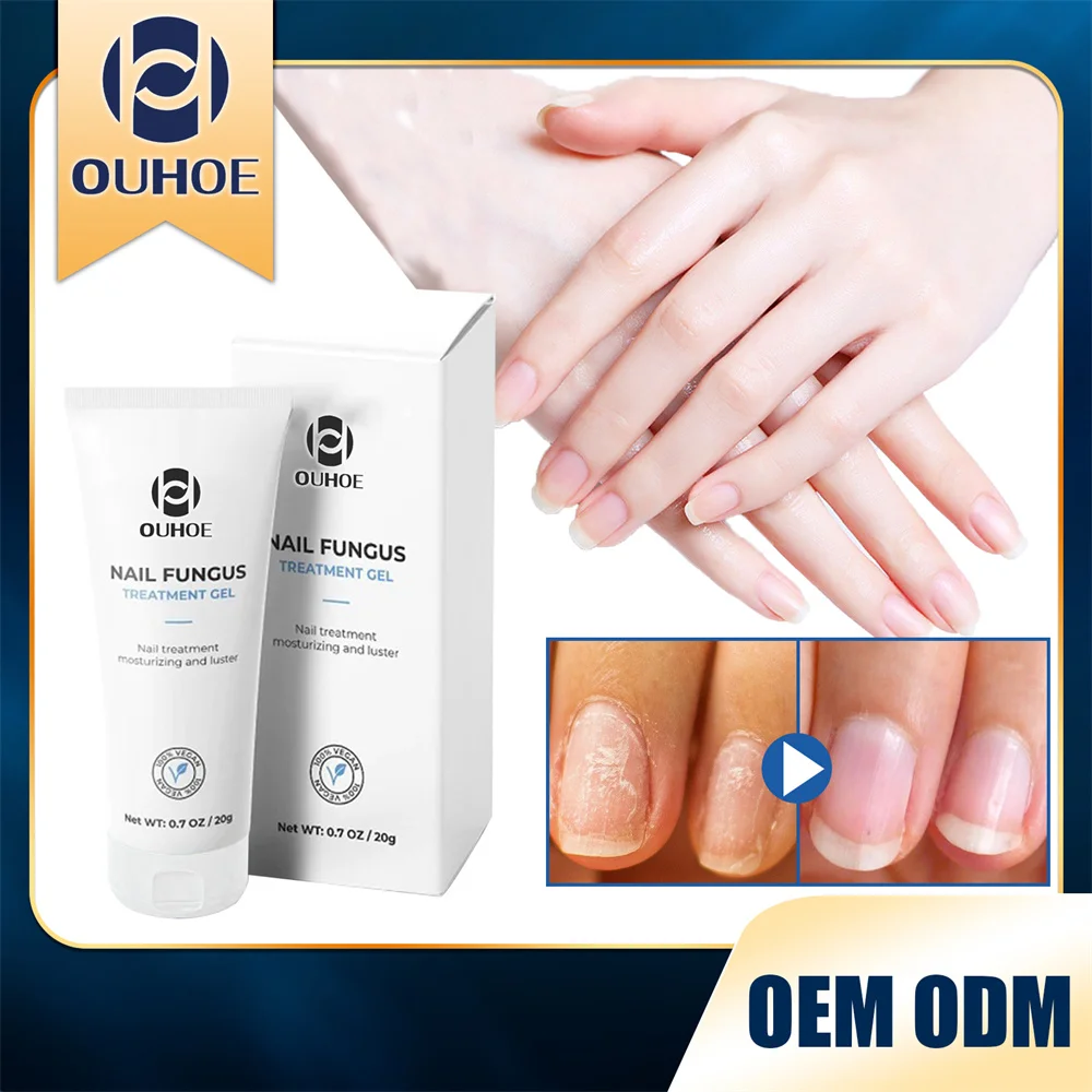 Pink Quick Extension G Health Care Easy To Apply Nourishing Hand And Foot Care Skin Care Absorb