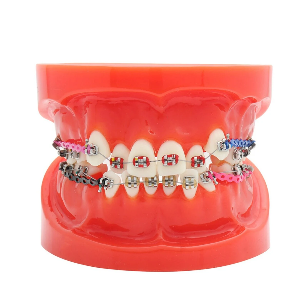 

Dental Teeth Model Orthodontic Treatment Study Demo Model For Teaching And Hospital Dentist Malocclusion Orthodontic Model