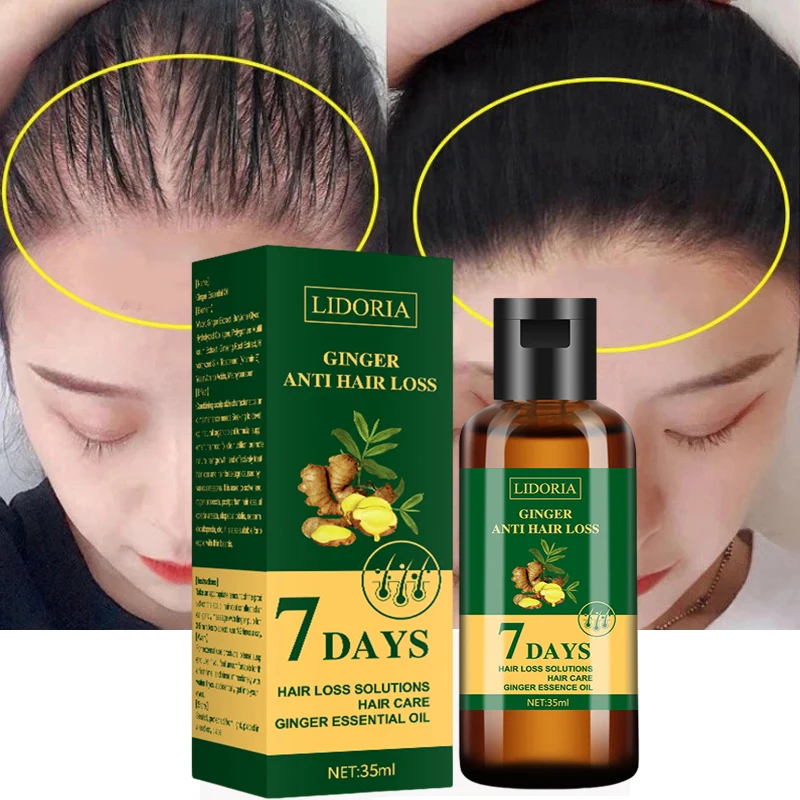 

7 дней, имбирь, быстрое устройство против выпадения волос, предотвращение истончения, восстановление, питание корней волос