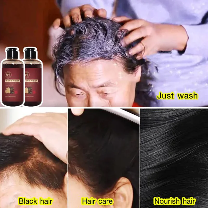 

Herbal Polygonum Shampoo 300mL Polygonum multiflorum white to black shampoo Effective Grey Hair Remover Anti White Hair Treatmen