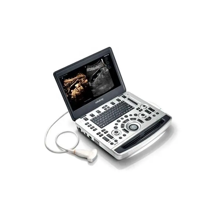 

Mindray color ultrasound machine/Mindray M9 laptop color doppler ultrasound