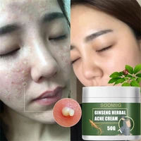 traditional chinese medicine acne cream is used for scar shrinking pore control oil whitening and moisturizing facial repair