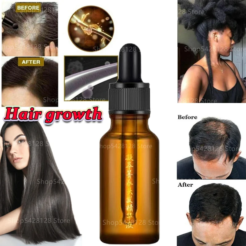 

Bald Hair Growth Hair Fast Growth Hair Growth Liquid To Prevent Loss of Dense Hair Without Hair Loss [6 Times Growth]
