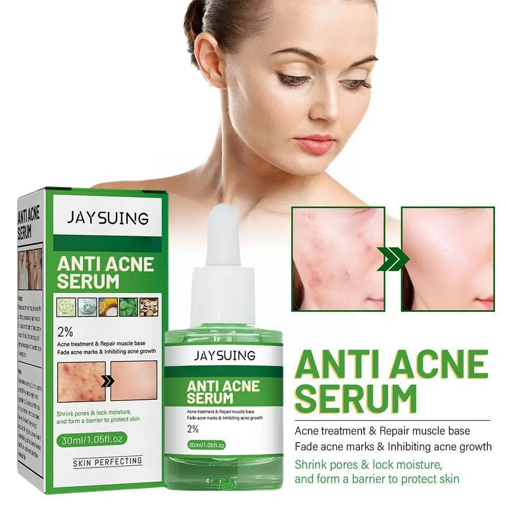 

30ml Anti Acne Facial Serum Acne Removal Lighten Acne Acne Treatment Skin Care Brighten Smooth Marks Moisturizing Oil-contr A6Y9