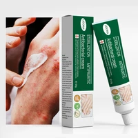 psoriasis antibacterial cream effectively relieves itching relieves skin dermatitis urticaria treatment desquamation body care