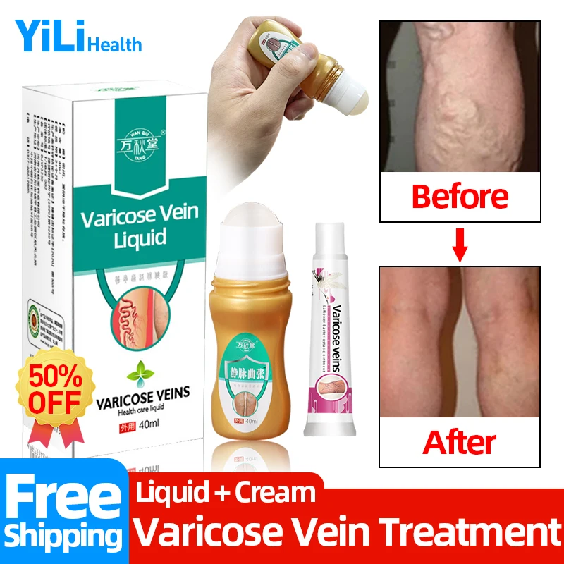 

Varicose Veins Wipe Liquid Treatment Vasculitis Phlebitis Spider Legs Varicosity Angiitis Miracle Cream Herbal Medical Plaster