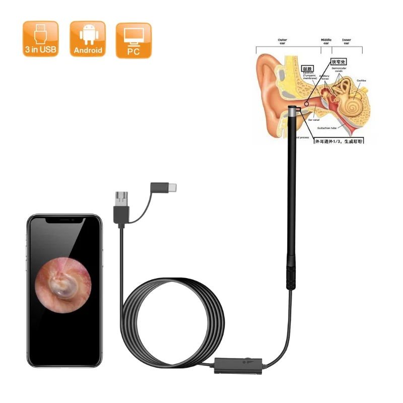 

Ear Endoscope Ear Pick Camera 5.5mm Otoscope Cleaner Dental Intraoral Inspect Camera Ear Removal Camera USB Endoscopio Medico
