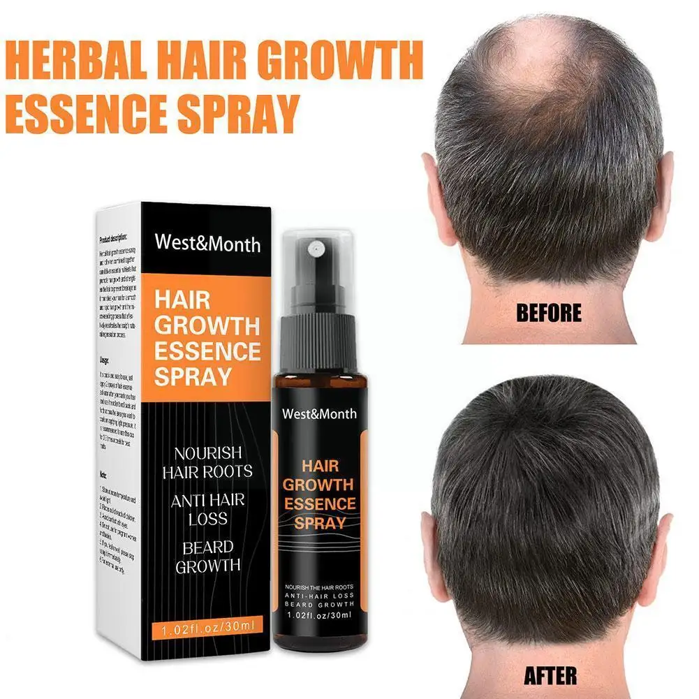 

Regrowth Ginger Spray Fast Hair Growth Fluid Anti Hair Prevent Essence Grow To Hair Hair Easy Dry Care Frizzy Loss Carry Fa Z7A4