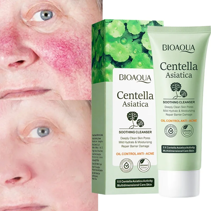 

Centella Asiatica Facial Cleanser Moisturizing Repair Soothing Sensitive Skin Blackhead Removal Anti-acne Oil Control Skin Care