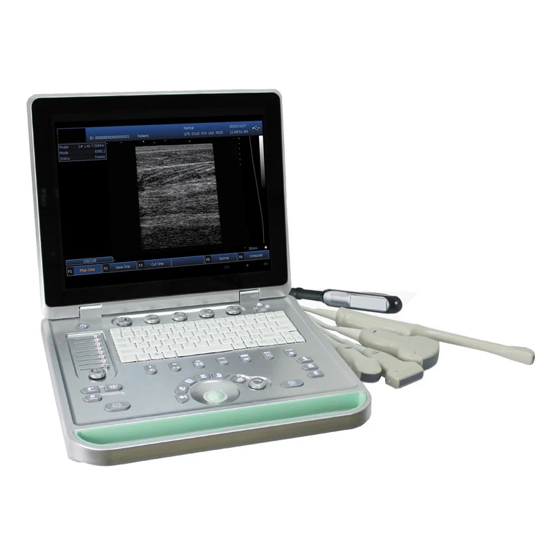 SY-A024 Портативный ультразвуковой 15-дюймовый светодиодный экран