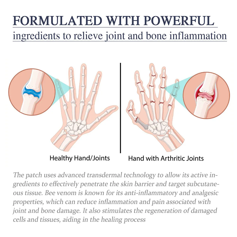 1/2/3 шт. 30 г крем для ухода за суставами пчел ремонт травм сухожилий облегчение