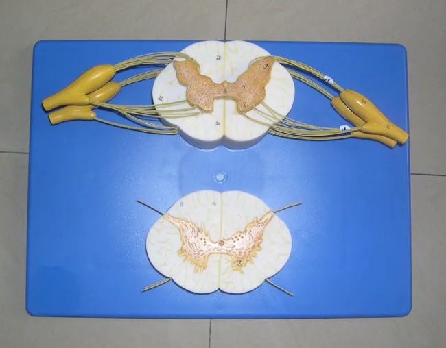 

Spinal Cord And Nerve Branch Amplification Model