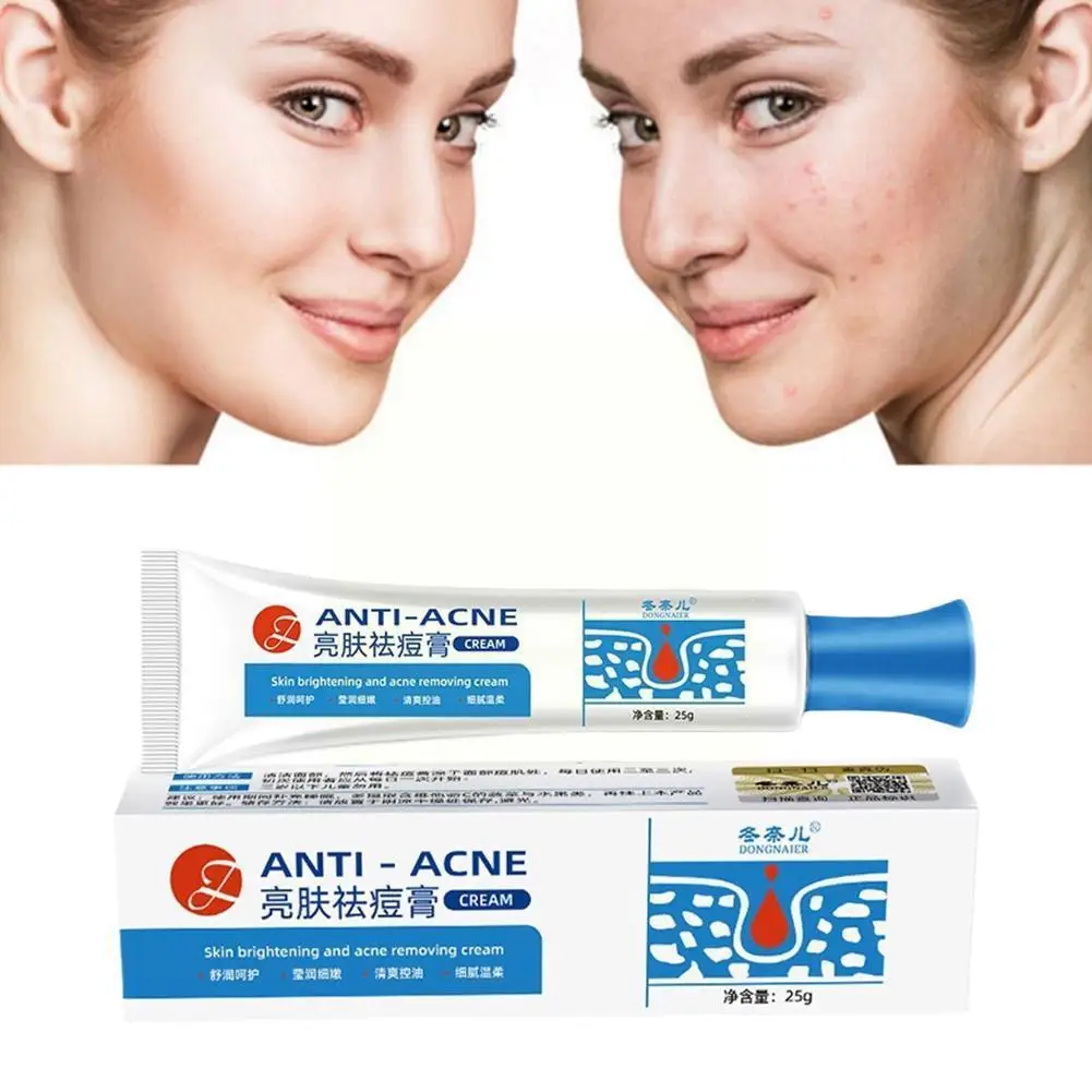 

Effective Acne Treatment Cream Anti Blackheads Acne Pores Brighten Beauty Skin Spots Care Smooth Products Shrink Moisturizi A1Q5
