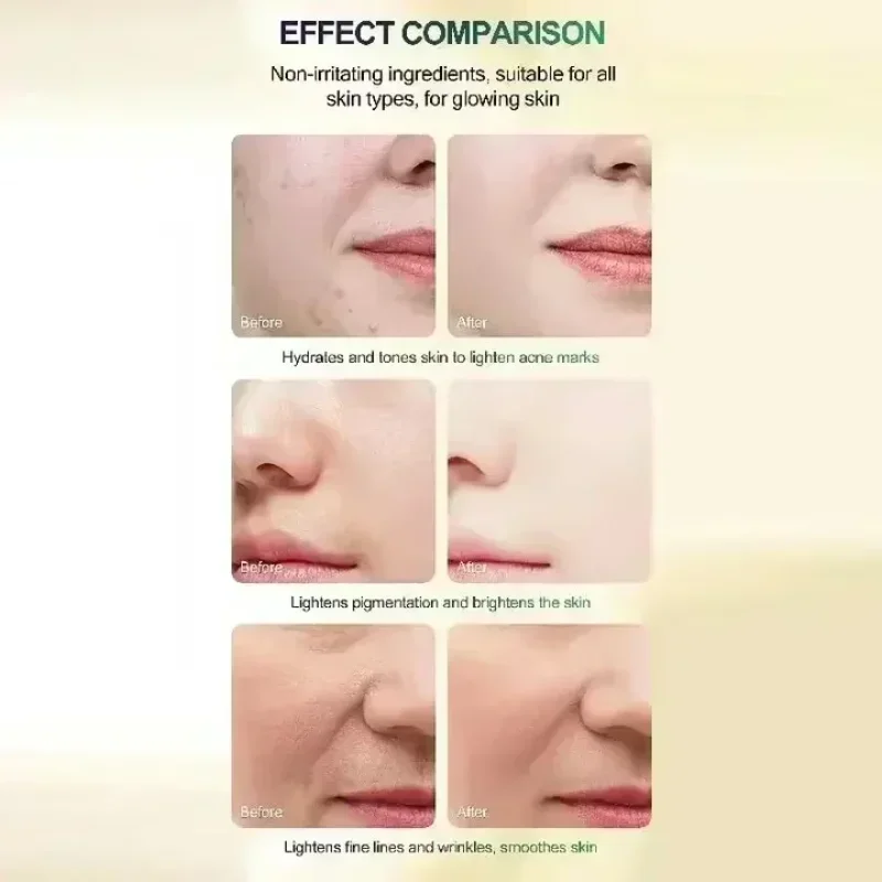 Лидер продаж кислотно-пилинг сыворотка-масло очищающее средство для лица