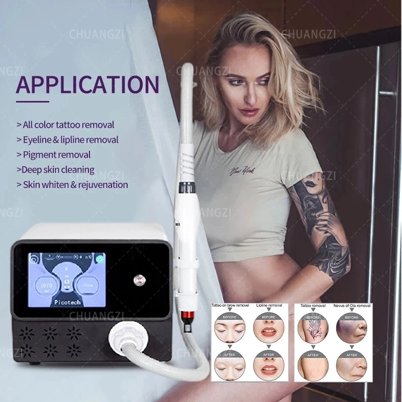 

2022 best q switch nd yag laser tattoo removal machine pico laser remove tattoo picosecond laser tattoo removal machine