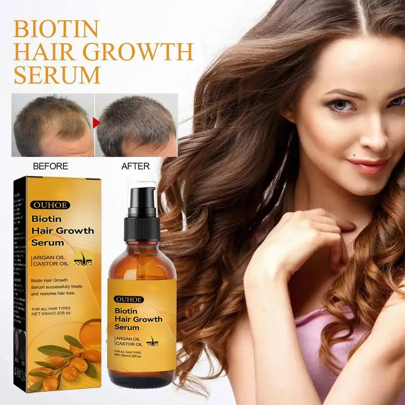 Scalp Treatmant Fast Growing Hair Care Essential Oils For Men Women
