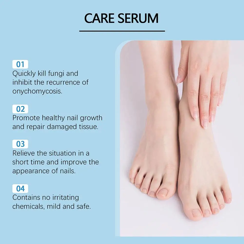 ł na grzybicę paznokci Serum do usuwania grzybów Przeciw infekcjom Paronychia Onychomycosis Paznokcie stóp Produkty pielęgnacji 30 мл