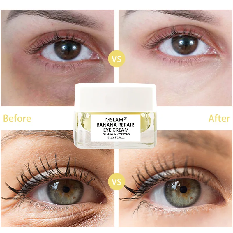 Banana Frost Age Nourishing Eye Cream Day and Night Whitening Face Cream  Face Lifting Cream  Skin Care