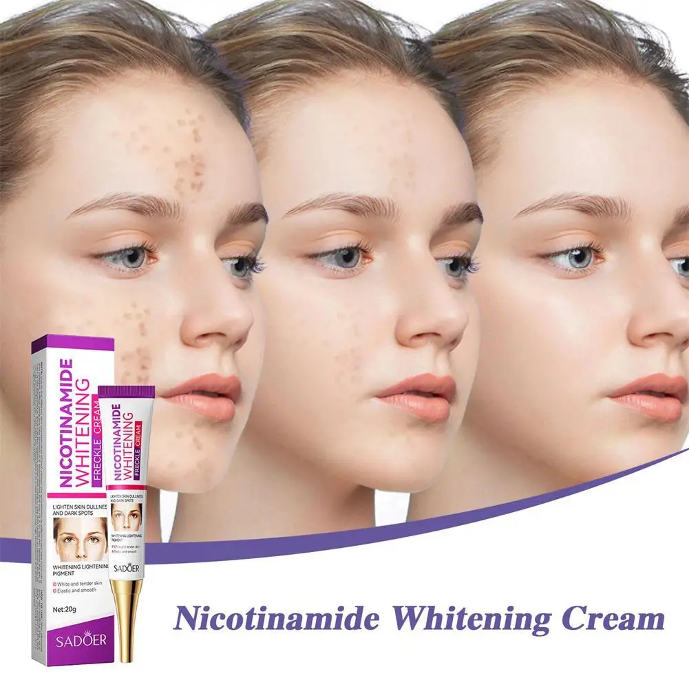 Powerful Nicotinamide Whitening Freckle Remover Cream Anti Brown Dark Spot Lighten Melasma Face Brighten Korean Skincare
