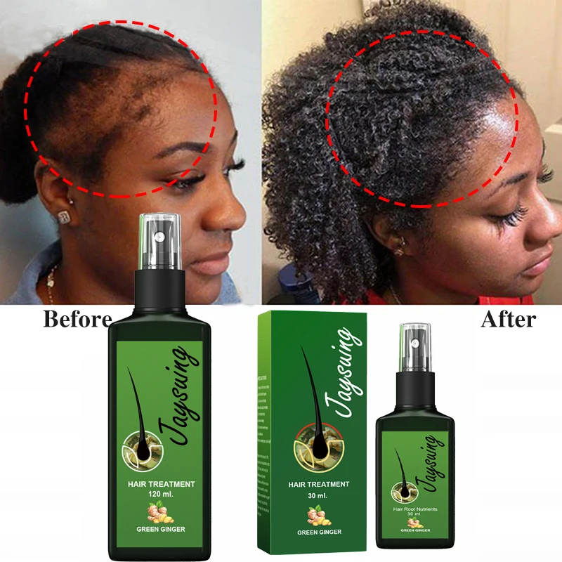 120ml Ginger Hair Growth Treatment Spray Serum Anti Loss Hair Care Improved Baldness Broken Dense Essence Oil Nutrients Unisex
