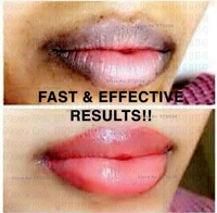 best extreme lightening pink lip scrub solutionpermanent pink lipdark lip corrector dark lip remover lip lightening scrub balm