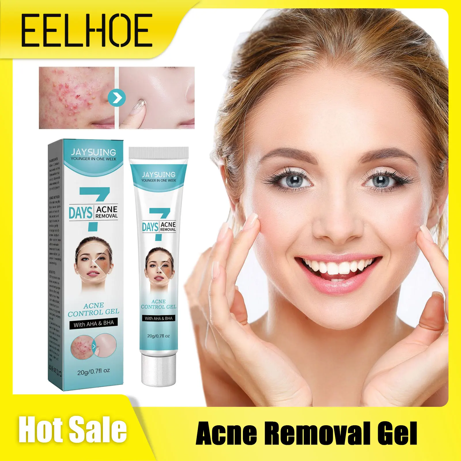 

Acne Treatment Cream Remove Pimple Scar Marks Oil Control Moisturize Repairing Damaged Brightening Pores Shrink Acne Removal Gel
