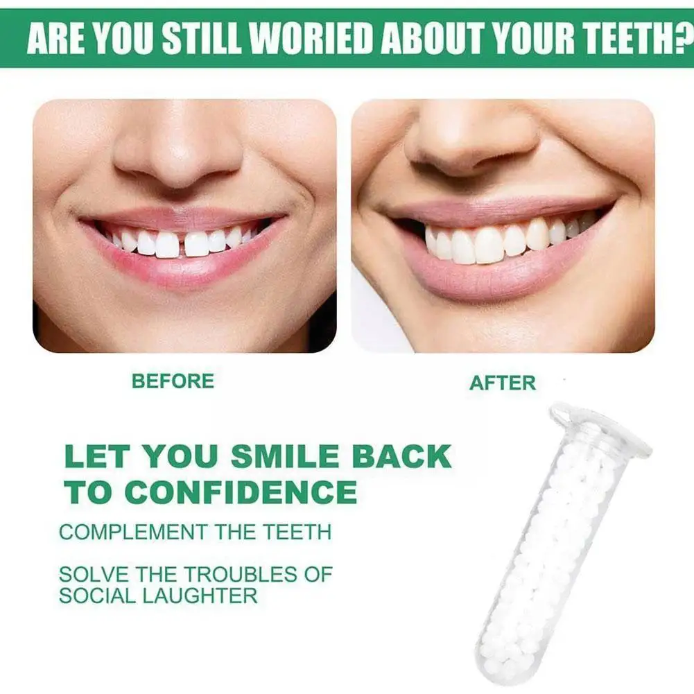 Набор для временного ремонта зубов клей отбеливания K2S9 |