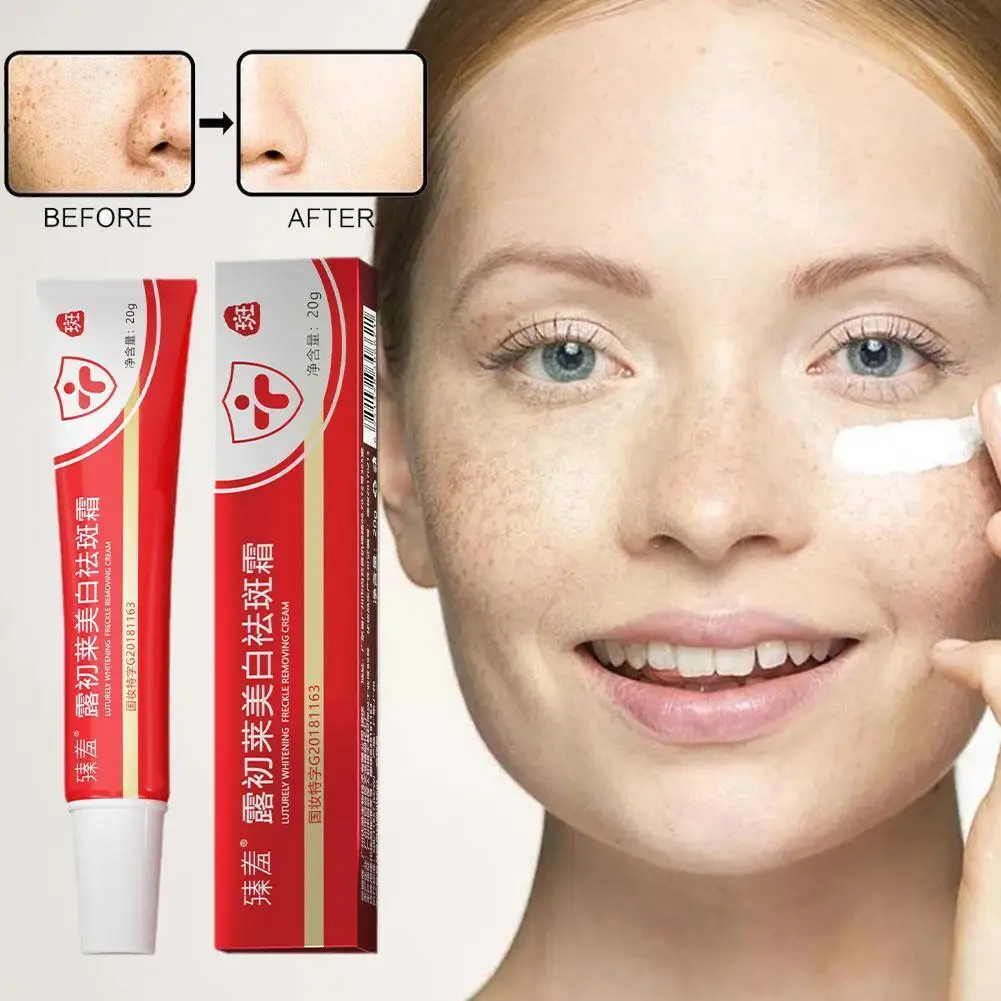 

Whitening Freckle Cream Melasma Dark Spots Remover Care Skin Korean 20g Products Lighten Smooth Brighten Moisturizing W5X4