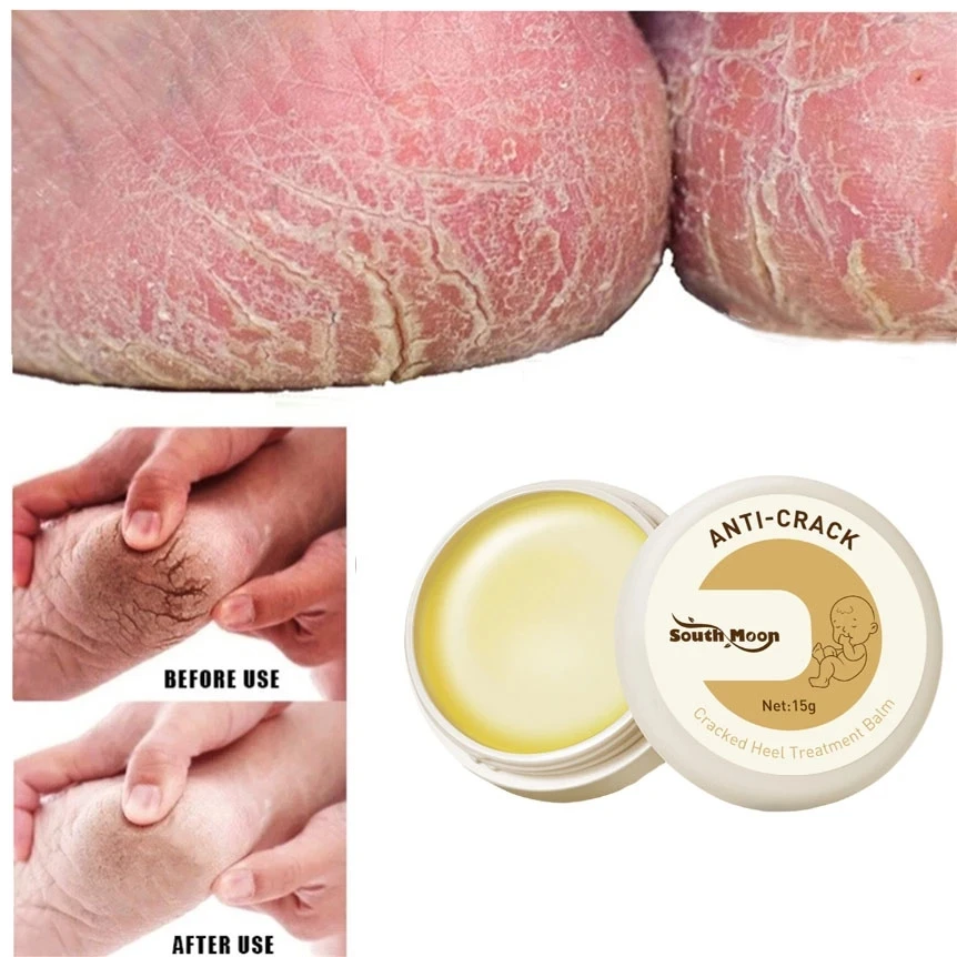 Anti-drying Removal Callus Dead Skin Balm Hand Foot Mositurizing Repair Skin Care Mask