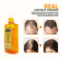 effective hair ginger shampoo professional anti hair loss baldness and dandruff shampoo hair regrowth dense fast thicker product
