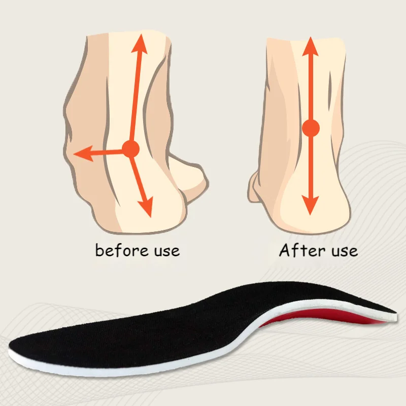 3D Arch Support Flat Feet For Women / Men Orthopedic Foot Pain Gel Pad   Youpin Premium Orthotic High Arch Support Insoles