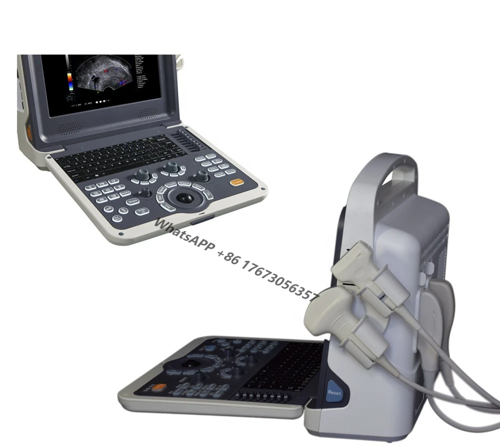 

Portable 4D Color Doppler Ultrasound Human / Veterinary