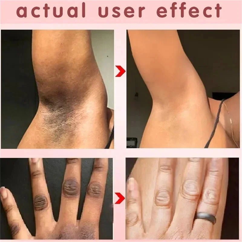 Осветляющий крем для внутренней части бедер отбеливающий подмышек локтей и