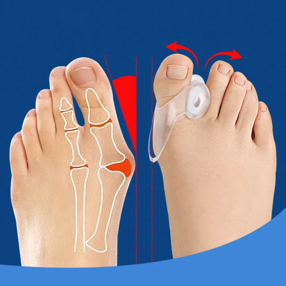 

2pcs Silicone Gel Bunion Big Toe Separator Spreader Eases Foot Pain Foot Hallux Valgus Correction Guard Cushion Concealer Thumb
