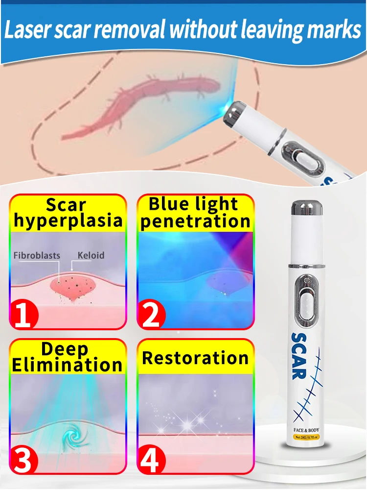 Хит продаж лазерный ремонт шрамов на коже