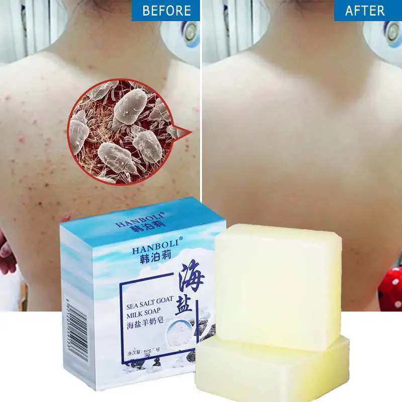 Sea Salt Soap Remover Pimple Pore Makeup Moisturize Face Wash Goat Milk Deep Cleansing Pores Blackheads Soft Skin | Красота и